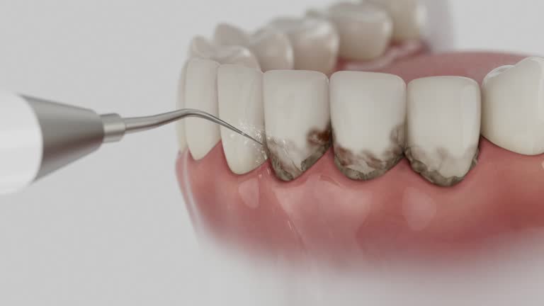 Reliable Emergency Dentist contractor in Berea, OH by Smile Center Dentistry